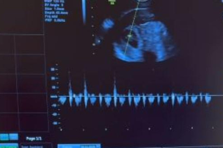 Ini Suami Sosok Siti Sintawati yang Viral Karena Hamil Kembar Setelah 8 Tahun Penantian