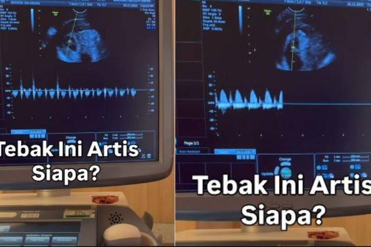 Viral! Terbongkar Sosok Siti Sintawati yang Diduga Jadi Nama Samaran Artis Beken Buat Tutupi Berita Kehamilan
