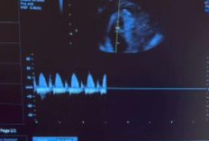 Siapa Siti Sintawati? Intip Profil dan Biodatanya Lengkap Di Sini, Ternyata Bukan Orang Sembarangan